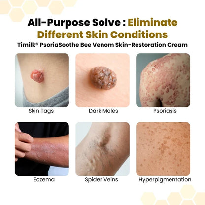 PsoriaSoothe Bee Venom Rescue Cream